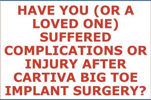 Have You or A Loved One Suffered Injury or Complications After Cartiva Big Toe Implant Surgery?